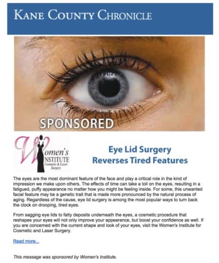Eye lid surgery article